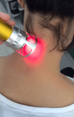 Terapia con láser