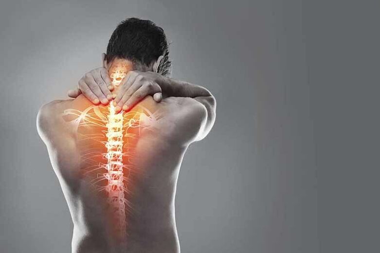 Osteocondrose da rexión do cérvix