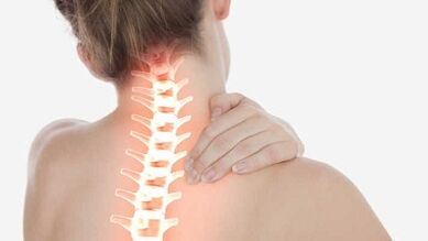 As principais manifestacións da osteocondrose cervical