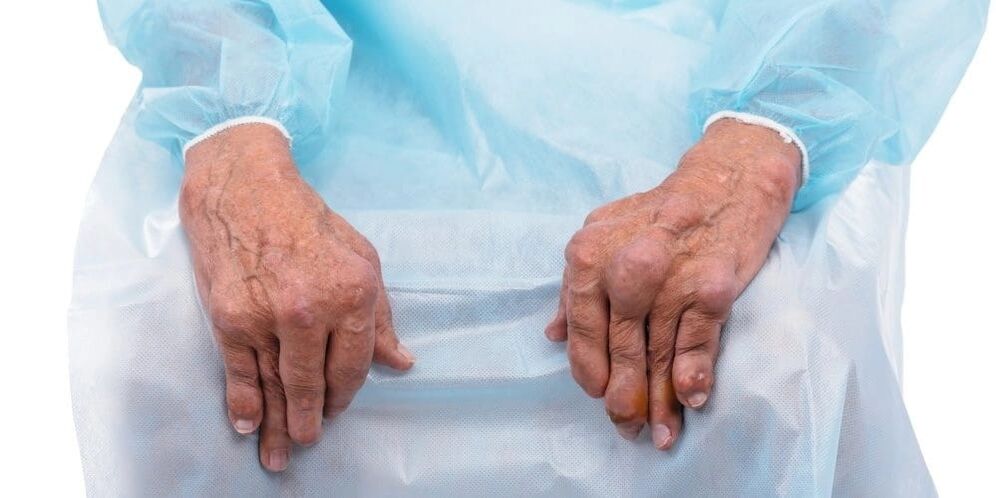 A artrite infecciosa é unha enfermidade con dor constante e cambios nas articulacións dos dedos.